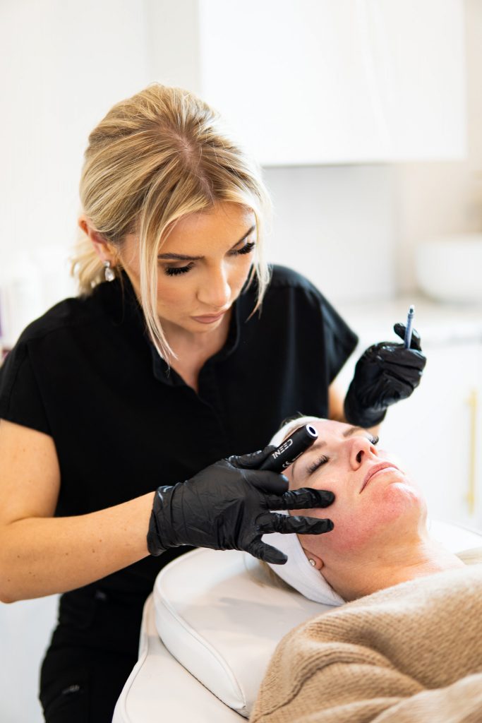 Microneedling