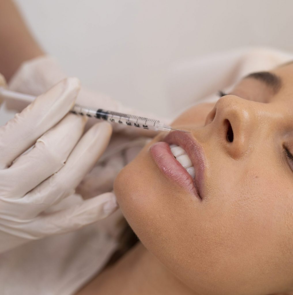 Dermal Fillers