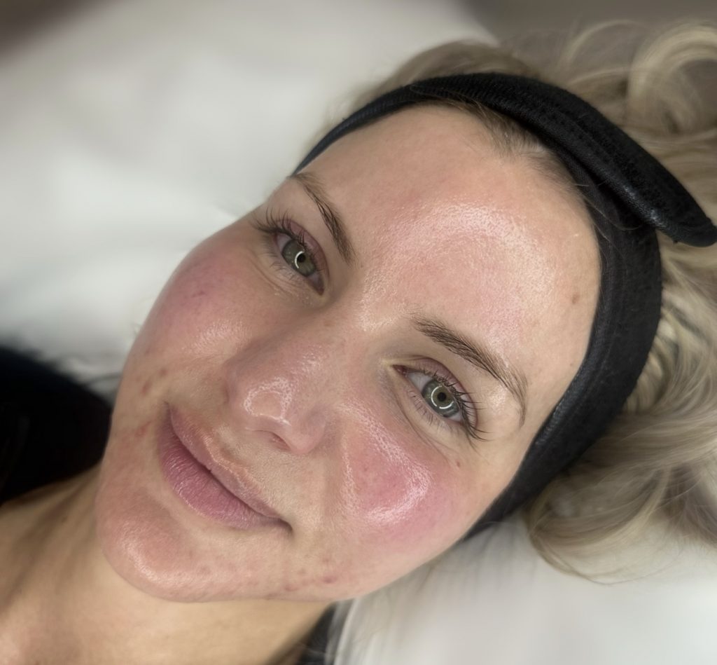 glass skin facial